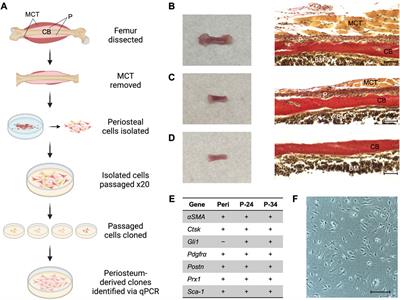 A periosteum-derived cell line to study the role of BMP/TGFβ signaling in periosteal cell behavior and function